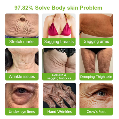 Rolimey® 👨‍⚕️👨‍⚕️𝑷𝑫𝑹𝑵 𝑨𝒏𝒕𝒊-𝑨𝒈𝒊𝒏𝒈 & 𝑻𝒂𝒓𝒈𝒆𝒕𝒆𝒅 𝑺𝒑𝒐𝒕 𝑹𝒆𝒏𝒆𝒘𝒂𝒍 𝑺𝒕𝒊𝒄𝒌（𝑯𝒆𝒍𝒑𝒔 𝑺𝒎𝒐𝒐𝒕𝒉 𝑾𝒓𝒊𝒏𝒌𝒍𝒆𝒔, 𝑺𝒖𝒑𝒑𝒐𝒓𝒕 𝑭𝒊𝒓𝒎𝒆𝒓-𝑳𝒐𝒐𝒌𝒊𝒏𝒈 𝑺𝒌𝒊𝒏, 𝒂𝒏𝒅 𝑰𝒎𝒑𝒓𝒐𝒗𝒆 𝑻𝒉𝒆 𝑨𝒑𝒑𝒆𝒂𝒓𝒂𝒏𝒄𝒆 𝑶𝒇 𝑽𝒊𝒔𝒊𝒃𝒍𝒆 𝑺𝒑𝒐𝒕𝒔）