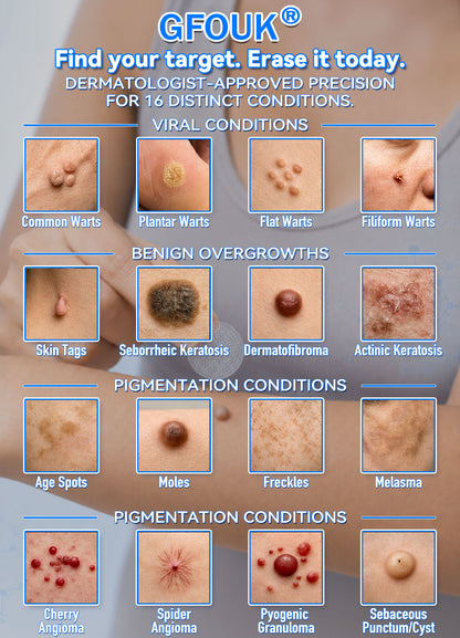 👩‍⚕️🏆 𝐎𝐟𝐟𝐢𝐜𝐢𝐚𝐥 𝐒𝐭𝐨𝐫𝐞 | GFOUK® 🌿 Botanical Microneedle Hydrocolloid Patch (For Skin Tags, Small Skin Growths, Warts, Moles, Age Spots & Pigmentation Concerns)