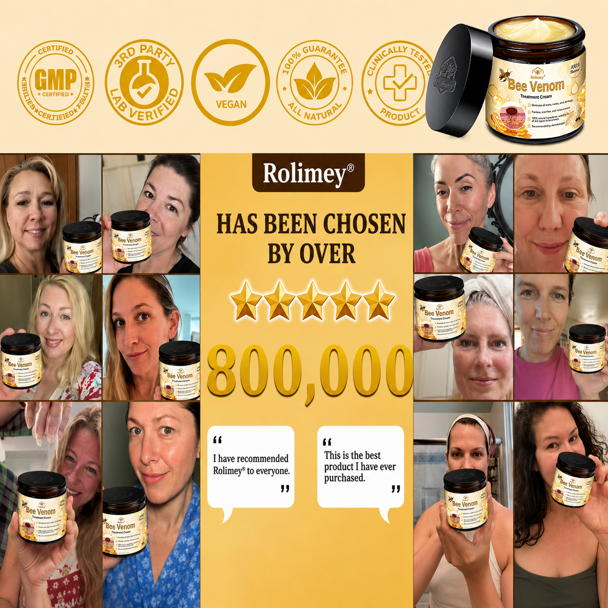 🔥Rolimey® Bee Venom Skin Treatment Cream - (Helping with acne, wart, rosacea, psoriasis, age spots, eczema, and reducing the appearance of stretch marks)