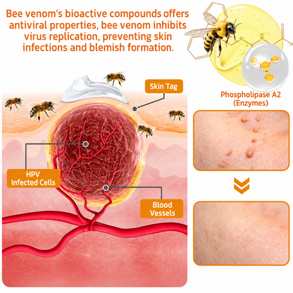Rolimey® Bee Venom Skin Treatment Cream🔥🔥
