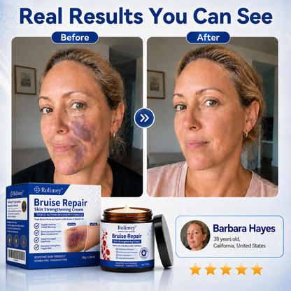 💦💦Over 100,000 units sold👨‍⚕️ - Rolimey® cream to repair bruises and strengthen the skin.