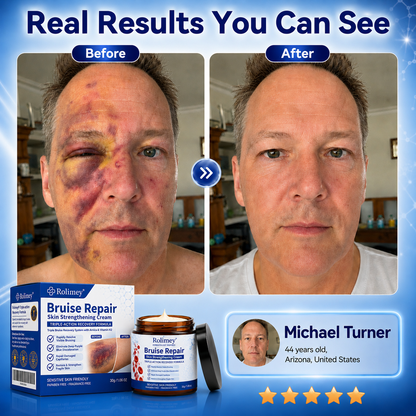 💦💦Over 100,000 units sold👨‍⚕️ - Rolimey® cream to repair bruises and strengthen the skin.
