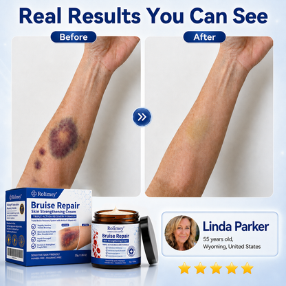 💦💦Over 100,000 units sold👨‍⚕️ - Rolimey® cream to repair bruises and strengthen the skin.