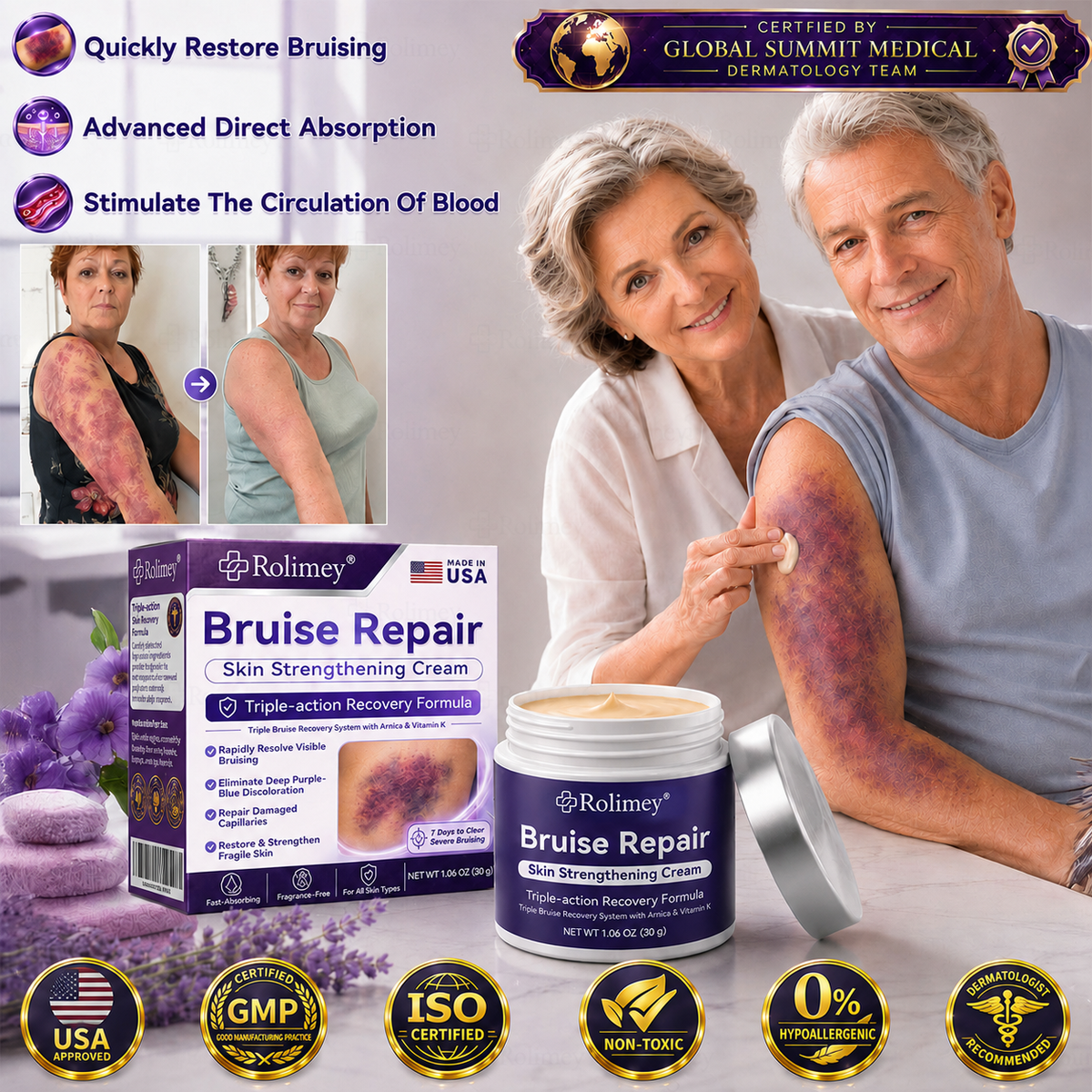 👨‍⚕️Over 100,000 units sold💕 - Rolimey® cream to repair bruises and strengthen the skin