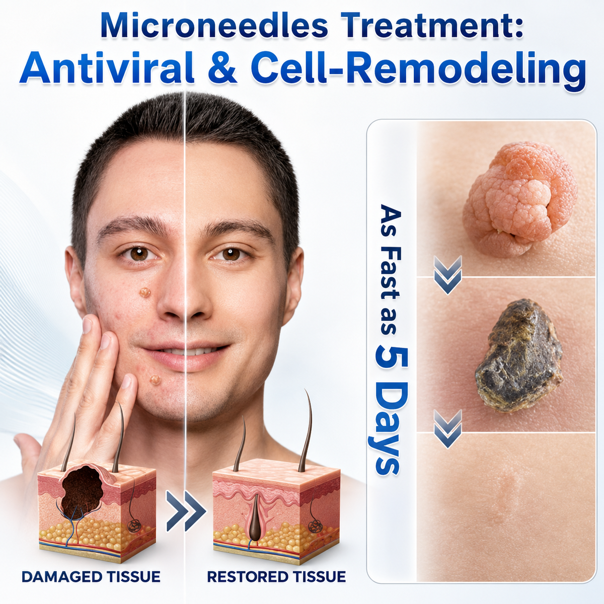 👩‍⚕️🏆 𝐎𝐟𝐟𝐢𝐜𝐢𝐚𝐥 𝐒𝐭𝐨𝐫𝐞 | GFOUK® 🌿 Botanical Microneedle Hydrocolloid Patch (For Skin Tags, Small Skin Growths, Warts, Moles, Age Spots & Pigmentation Concerns)