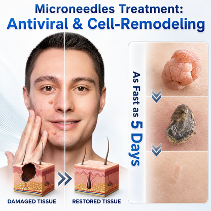 👩‍⚕️🏆 𝐎𝐟𝐟𝐢𝐜𝐢𝐚𝐥 𝐒𝐭𝐨𝐫𝐞 | GFOUK® 🌿 Botanical Microneedle Hydrocolloid Patch (For Skin Tags, Small Skin Growths, Warts, Moles, Age Spots & Pigmentation Concerns)