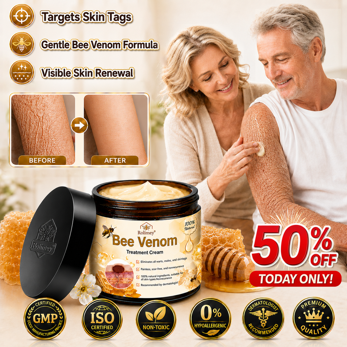 ✅✅Rolimey® Bee Venom Skin Treatment Cream - (Helping with acne, rosacea, psoriasis, age spots, eczema, and reducing the appearance of stretch marks)