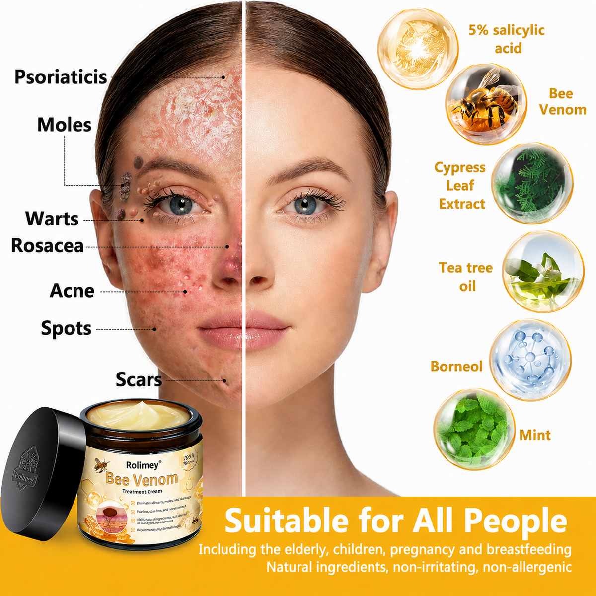Rolimey® Bee Venom Skin Treatment Cream🔥🔥