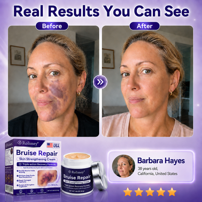 🔥Over 100,000 units sold👨‍⚕️ - Rolimey® cream to repair bruises and strengthen the skin.