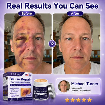 👨‍⚕️Over 100,000 units sold💕 - Rolimey® cream to repair bruises and strengthen the skin