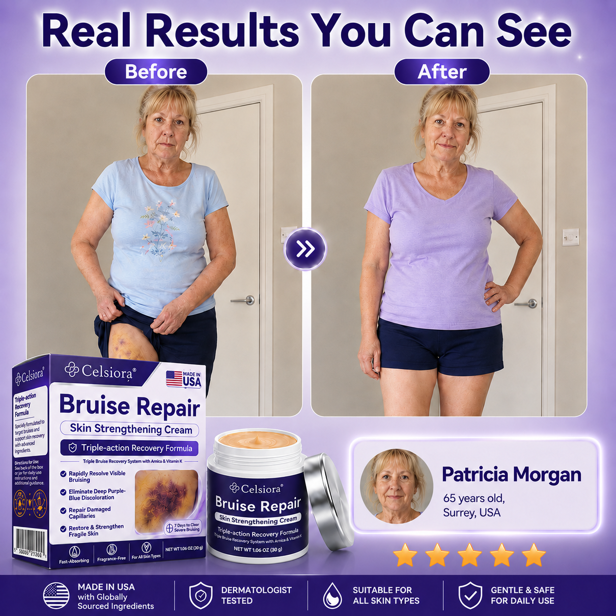 👨‍⚕️Over 100,000 units sold💕 - Rolimey® cream to repair bruises and strengthen the skin