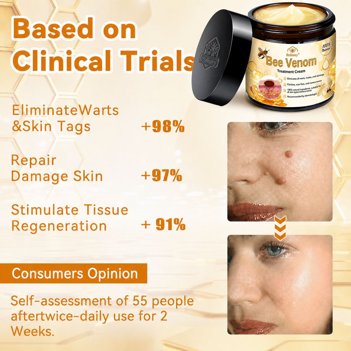 Rolimey® Bee Venom Skin Treatment Cream🔥🔥