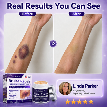👨‍⚕️Over 100,000 units sold💕 - Rolimey® cream to repair bruises and strengthen the skin