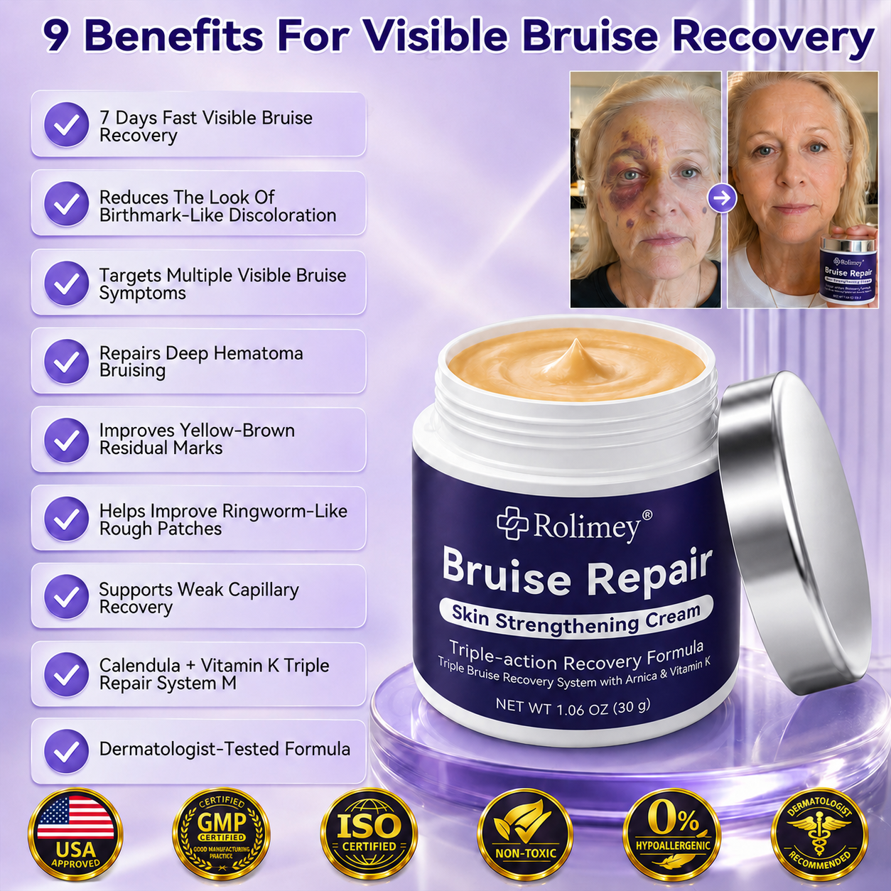 🔥Over 100,000 units sold👨‍⚕️ - Rolimey® cream to repair bruises and strengthen the skin.