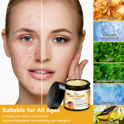 🌿Rolimey® Bee Venom Skin Treatment Cream - (Helping with acne, wart, rosacea, psoriasis, age spots, eczema, and reducing the appearance of stretch marks)