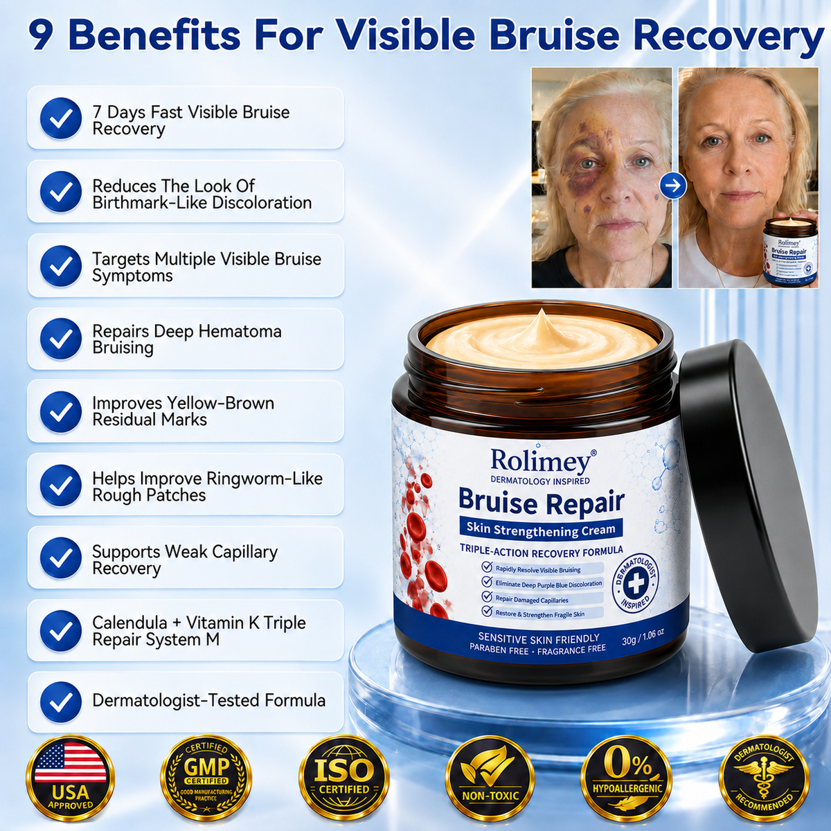 💦💦Over 100,000 units sold👨‍⚕️ - Rolimey® cream to repair bruises and strengthen the skin.