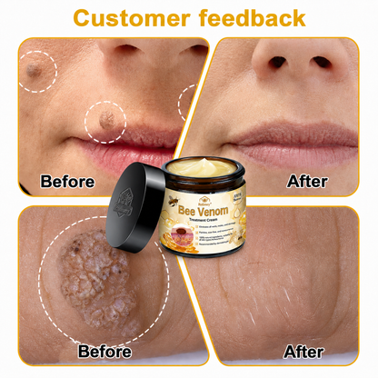 Rolimey® Bee Venom Skin Treatment Cream🔥🔥